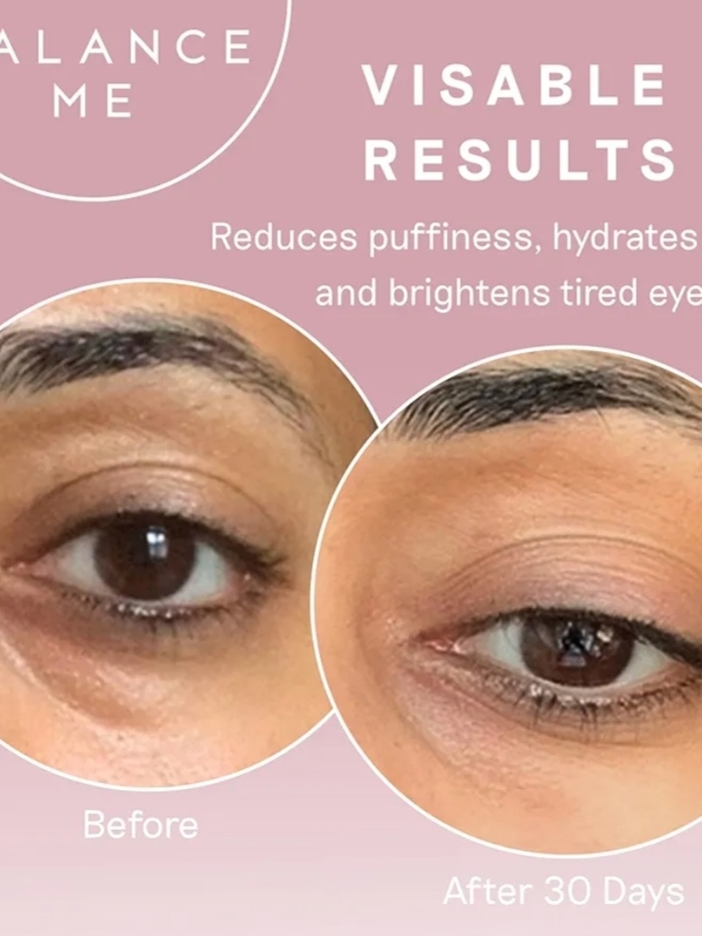 Balance Me Wonder Eye Cream — Hydrating Pink & Silver Eye Care - Picture 3 of 5
